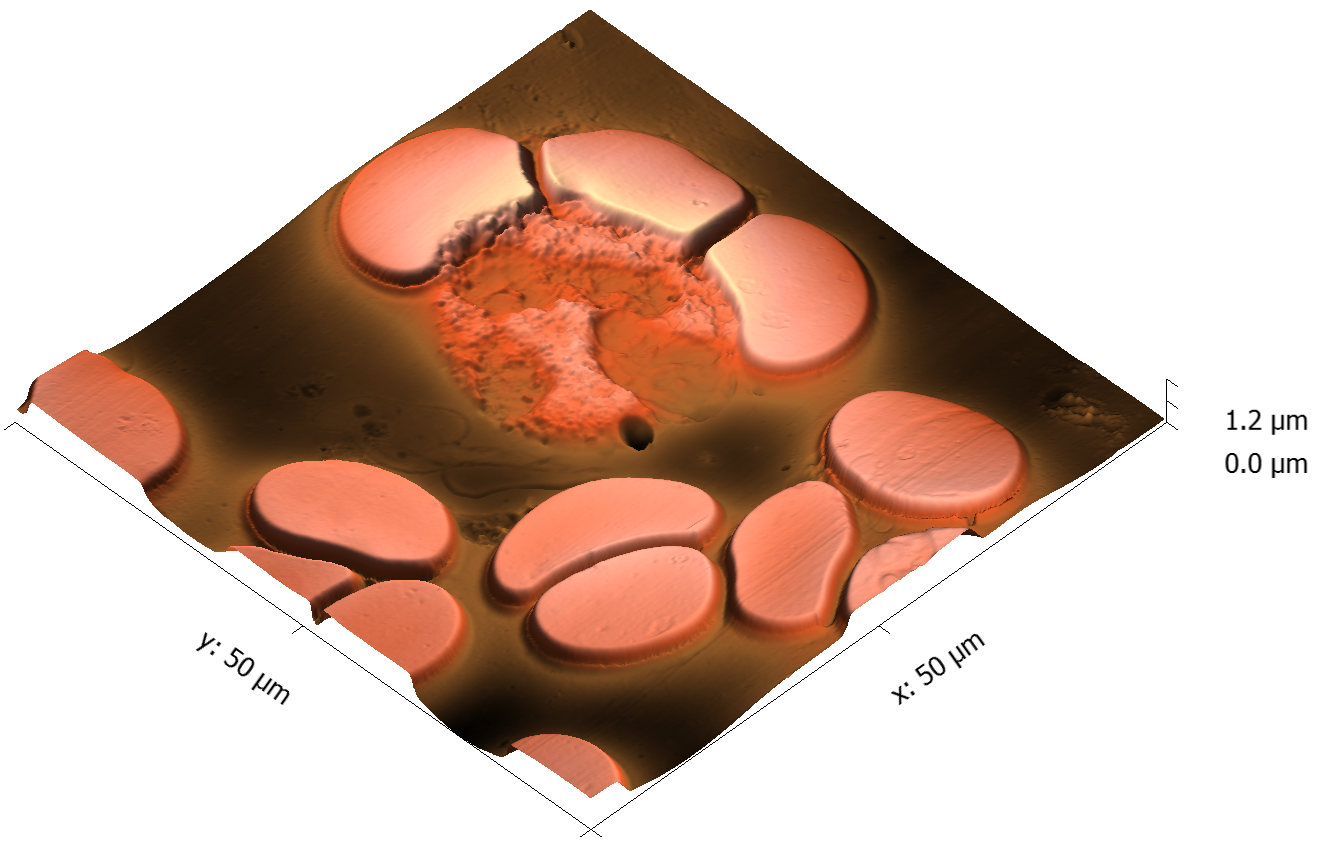 Blood Smear